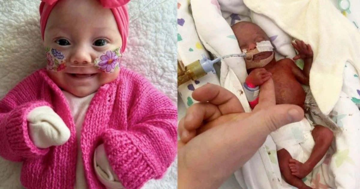Bebê que nasceu de 22 semanas com 500 gramas tem alta e vai para casa: “Hope”